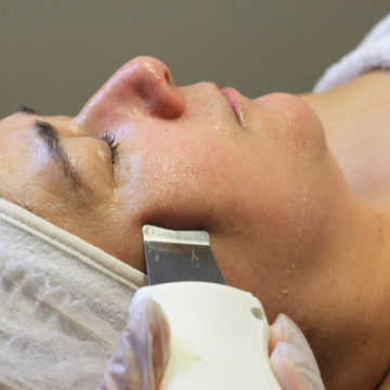 Peeling Ultrassónico