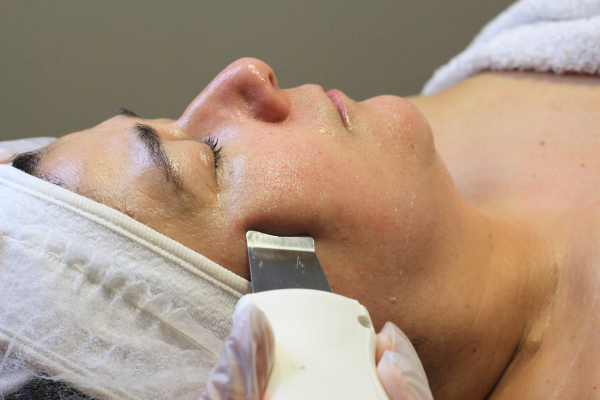 Peeling Ultrassónico